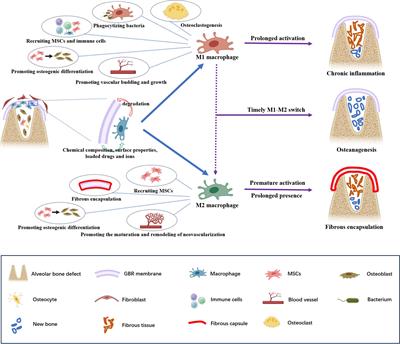 Macrophages in guided bone regeneration: potential roles and future directions